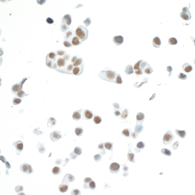 CDK7 Antibody in Immunocytochemistry (ICC/IF)