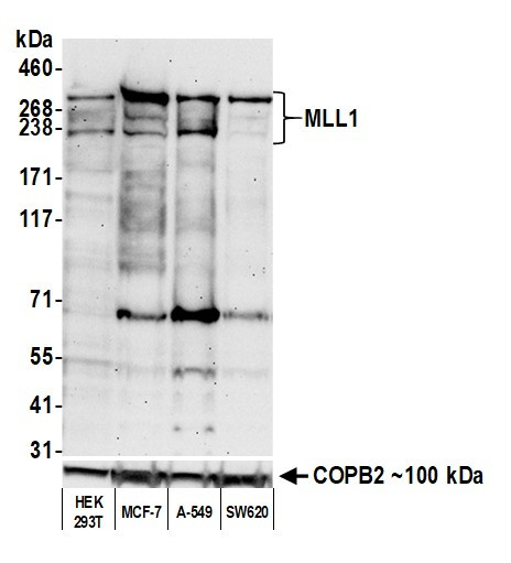 MLL1 Antibody in Western Blot (WB)