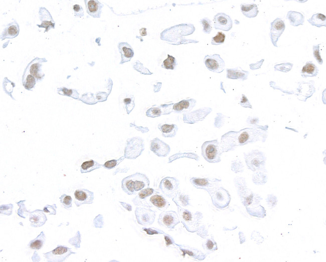 SMC1 Antibody in Immunocytochemistry (ICC/IF)