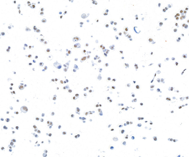 CTCF Antibody in Immunocytochemistry (ICC/IF)