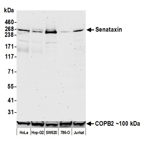 Senataxin Antibody in Western Blot (WB)