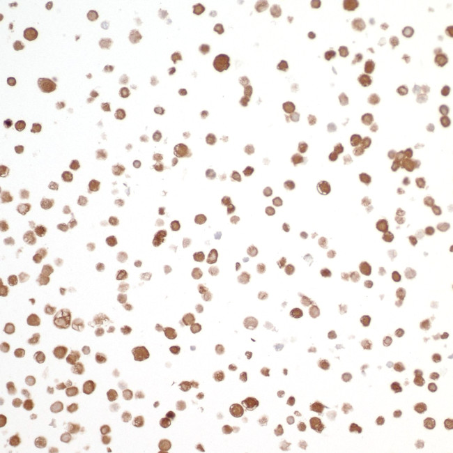 NAMPT/PBEF/Visfatin Antibody in Immunocytochemistry (ICC/IF)