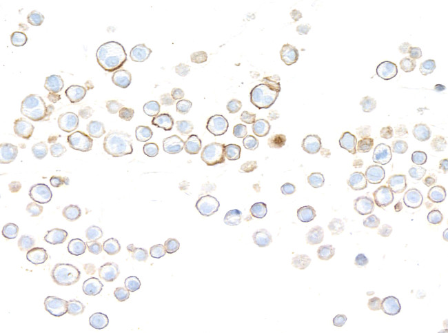 HVEM/TNFRSF14 Antibody in Immunocytochemistry (ICC/IF)