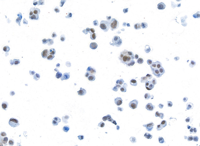 BRD3 Antibody in Immunocytochemistry (ICC/IF)