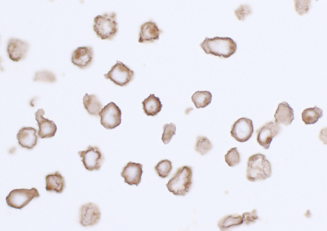 PDGFR alpha Antibody in Immunocytochemistry (ICC/IF)