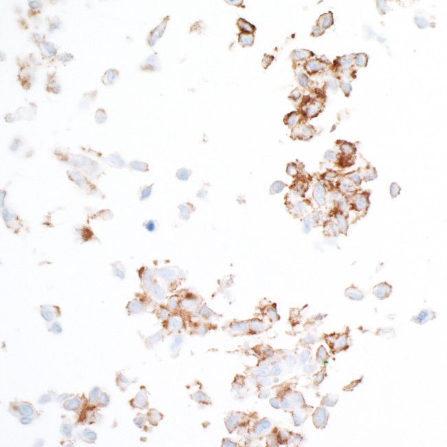 PDGFR beta Antibody in Immunocytochemistry (ICC/IF)