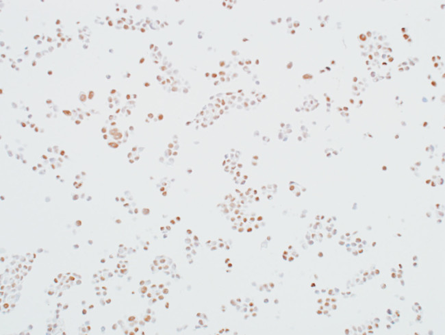 MED12 Antibody in Immunocytochemistry (ICC/IF)