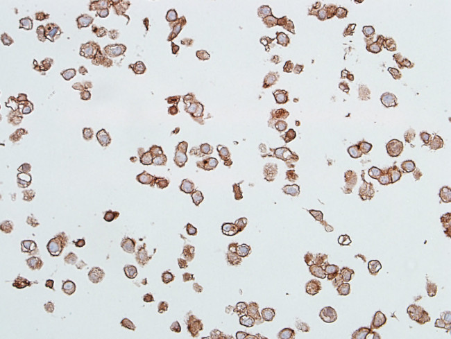 CEACAM1 Antibody in Immunocytochemistry (ICC/IF)