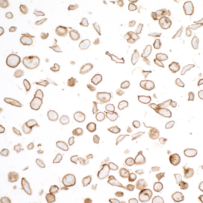 N-Cadherin Antibody in Immunocytochemistry (ICC/IF)