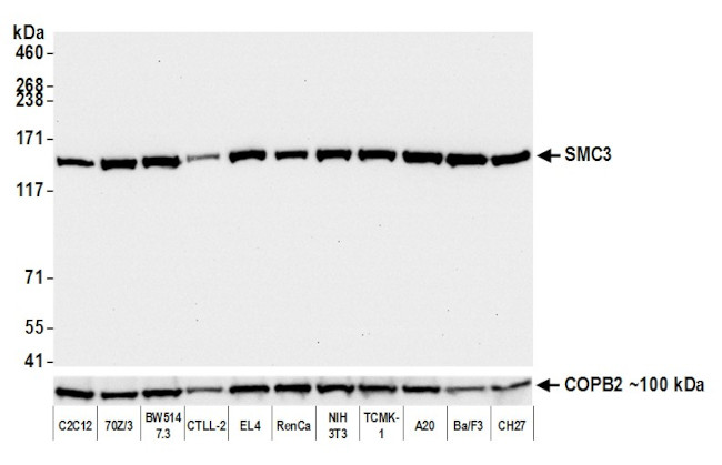 SMC3 Antibody in Western Blot (WB)