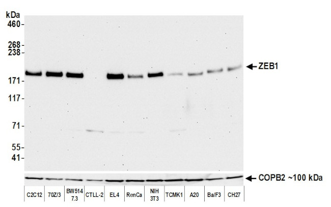 ZEB1 Antibody in Western Blot (WB)