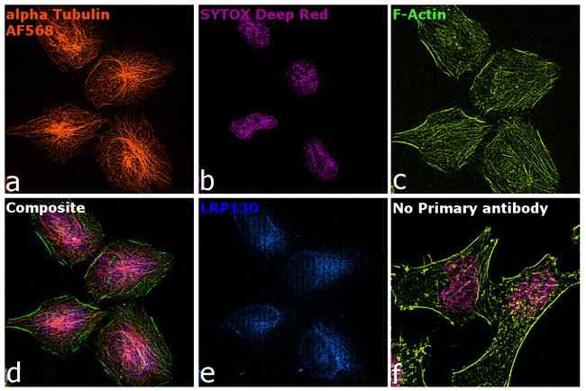 Rat IgG (H+L) Highly Cross-Adsorbed Secondary Antibody in Immunocytochemistry (ICC/IF)