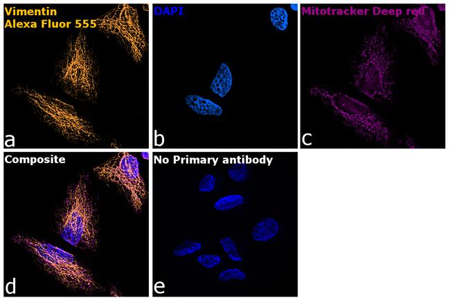 Chicken IgY (H+L) Highly Cross Adsorbed Secondary Antibody in Immunocytochemistry (ICC/IF)