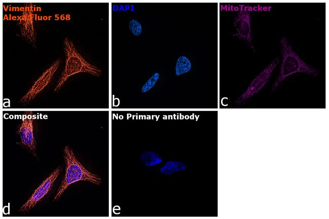 Chicken IgY (H+L) Highly Cross Adsorbed Secondary Antibody in Immunocytochemistry (ICC/IF)