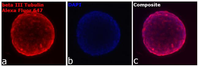 Chicken IgY (H+L) Highly Cross Adsorbed Secondary Antibody in Immunocytochemistry (ICC/IF)