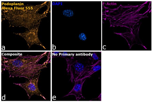 Syrian Hamster IgG (H+L) Highly Cross-Adsorbed Secondary Antibody in Immunocytochemistry (ICC/IF)