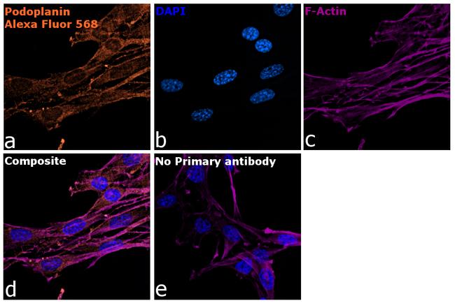 Syrian Hamster IgG (H+L) Highly Cross-Adsorbed Secondary Antibody in Immunocytochemistry (ICC/IF)