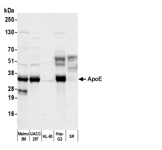 ApoE Antibody in Western Blot (WB)