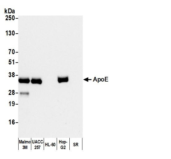 ApoE Antibody in Western Blot (WB)