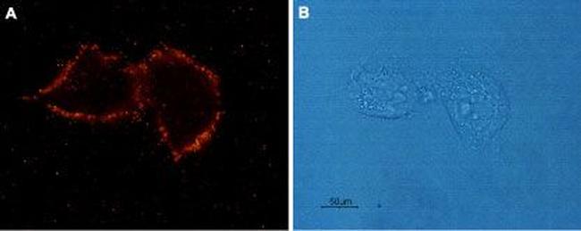 Angiotensin II Receptor Type-1 (extracellular) Antibody in Immunocytochemistry (ICC/IF)