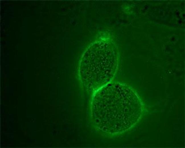 Angiotensin II Receptor Type-2 (extracellular) Antibody in Immunocytochemistry (ICC/IF)