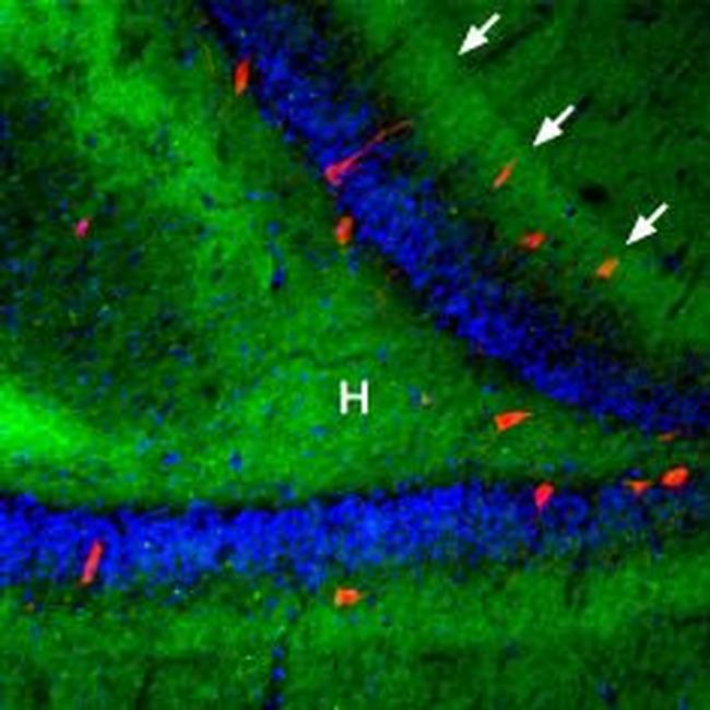 beta 3-Adrenergic Receptor (extracellular) Antibody in Immunohistochemistry (IHC)