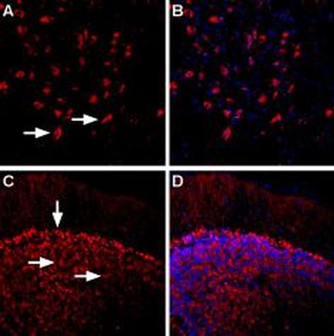 beta 1-Adrenergic Receptor (extracellular) Antibody in Immunohistochemistry (IHC)