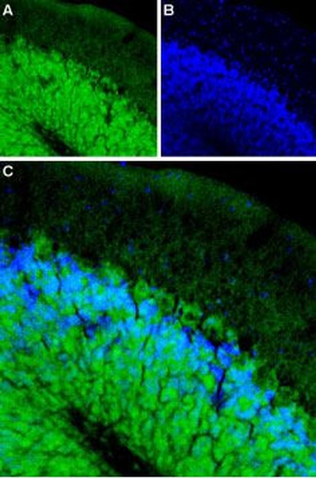 beta 1-Adrenergic Receptor (extracellular) Antibody in Immunohistochemistry (IHC)