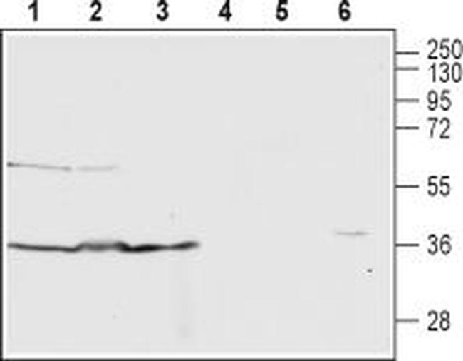 C5aR1 (extracellular) Antibody in Western Blot (WB)