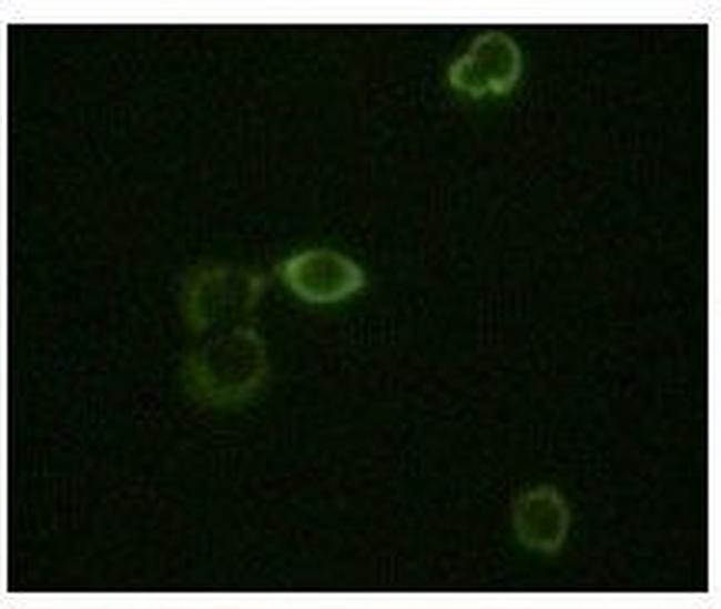 Abl2 Antibody in Immunocytochemistry (ICC/IF)