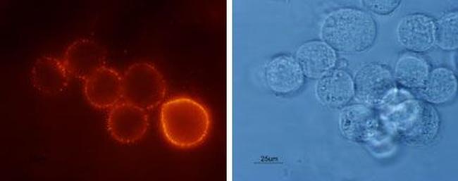 Bombesin Receptor 2 (GRPR) (extracellular) Antibody in Immunocytochemistry (ICC/IF)