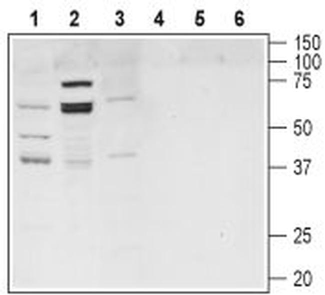 TGR5 (GPBAR1) Antibody in Western Blot (WB)