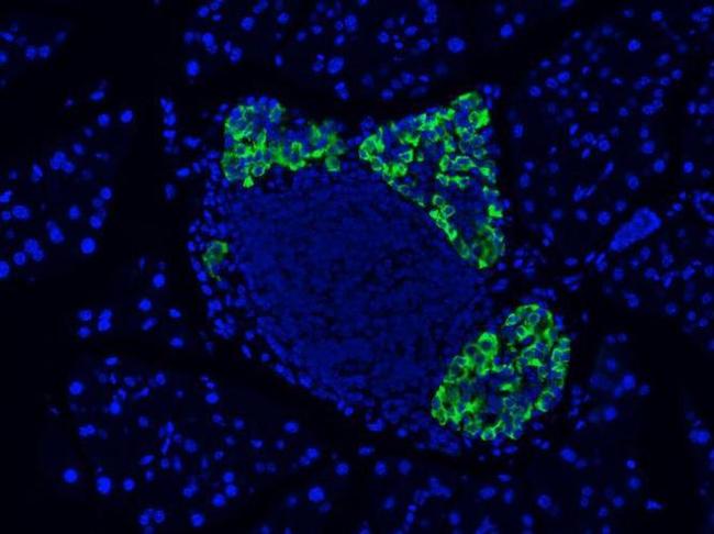 GLP-1 Antibody in Immunohistochemistry (IHC)