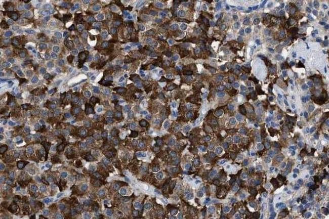 Leptin Antibody in Immunohistochemistry (IHC)