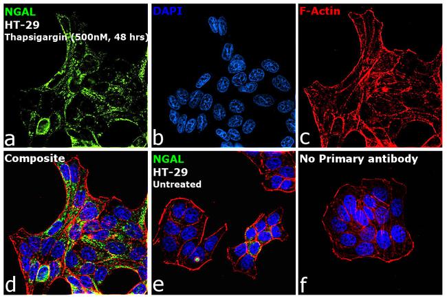 NGAL Antibody in Immunocytochemistry (ICC/IF)