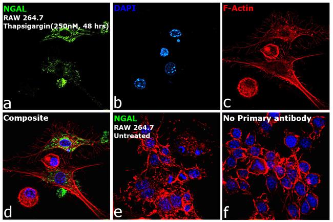 NGAL Antibody in Immunocytochemistry (ICC/IF)