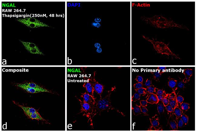 NGAL Antibody in Immunocytochemistry (ICC/IF)