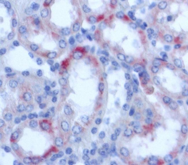 NGAL Antibody in Immunohistochemistry (Paraffin) (IHC (P))