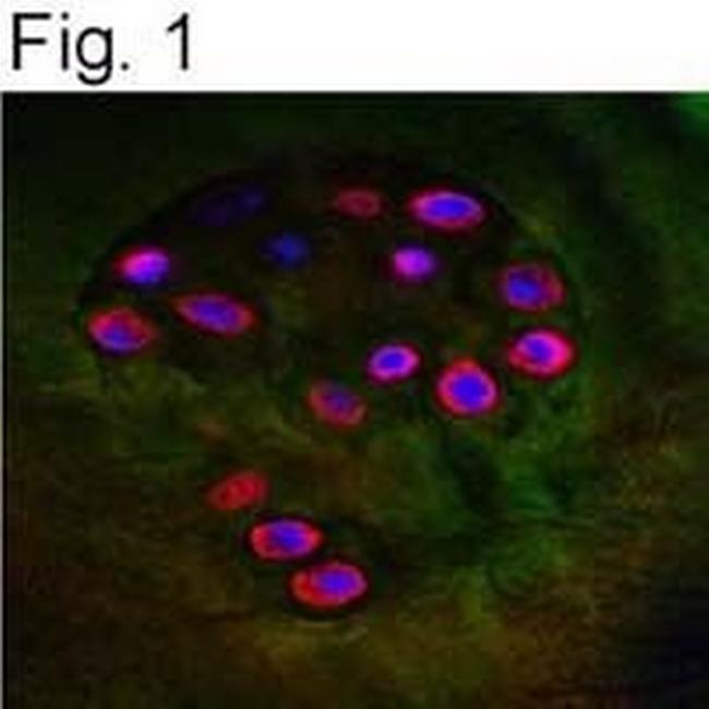 Aggrecan Neo Antibody in Immunohistochemistry (IHC)