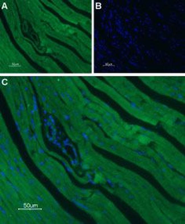 CaV1.2 (CACNA1C) Antibody in Immunohistochemistry (Paraffin) (IHC (P))