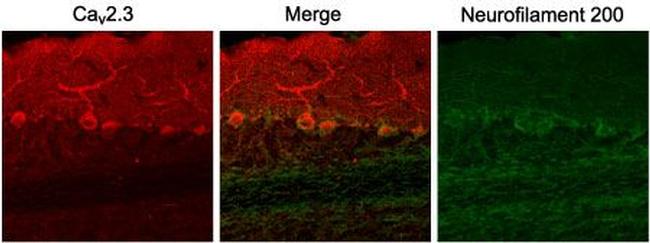 CaV2.3 (CACNA1E) Antibody in Immunohistochemistry (IHC)