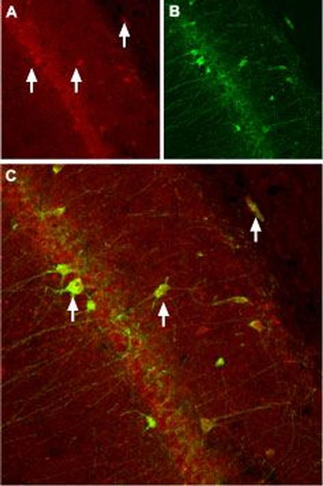 CACNB3 Antibody in Immunohistochemistry (IHC)