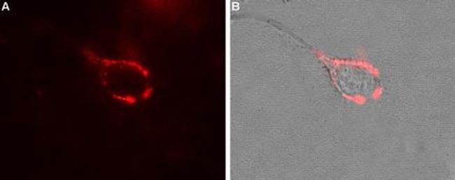 CACNA2D1 (CaV alpha 2 delta 1) (extracellular) Antibody in Immunocytochemistry (ICC/IF)