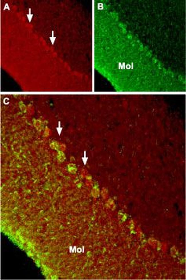 TRPC6 Antibody in Immunohistochemistry (IHC)