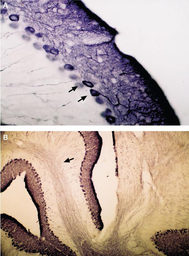 IP3 Receptor-1 (ITPR1) Antibody in Immunohistochemistry (IHC)