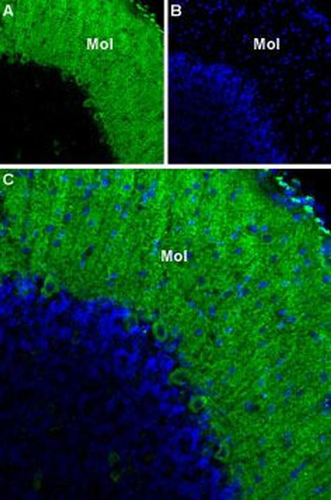 CACNA1G (CaV3.1) Antibody in Immunohistochemistry (IHC)