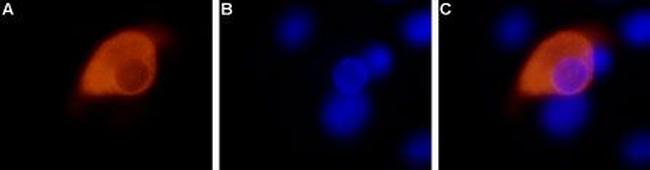 TRPV1 (VR1) Antibody in Immunocytochemistry (ICC/IF)