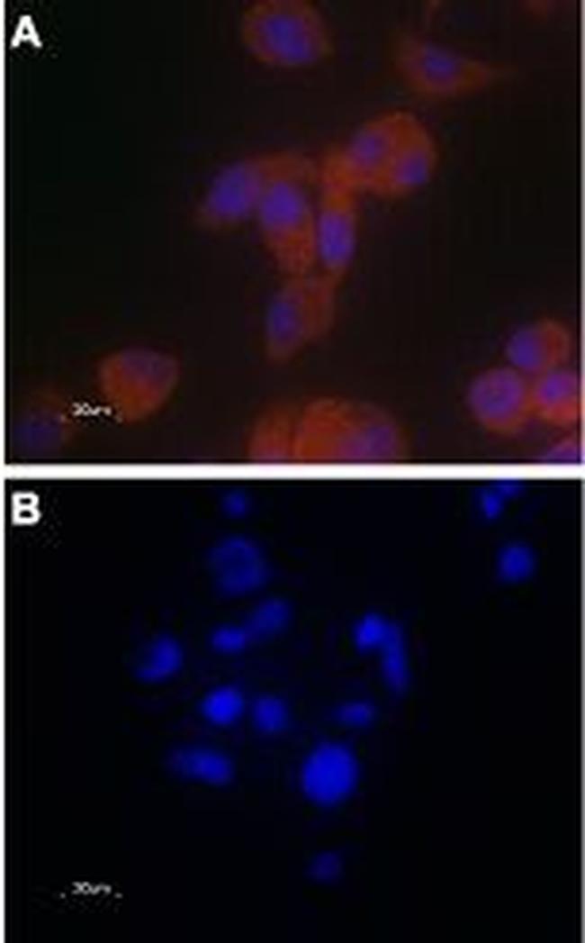 TRPV6 Antibody in Immunocytochemistry (ICC/IF)