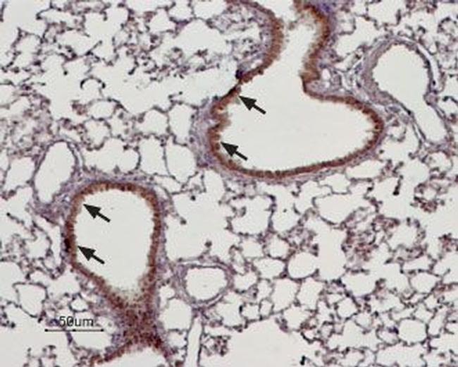 TRPM4 Antibody in Immunohistochemistry (Paraffin) (IHC (P))