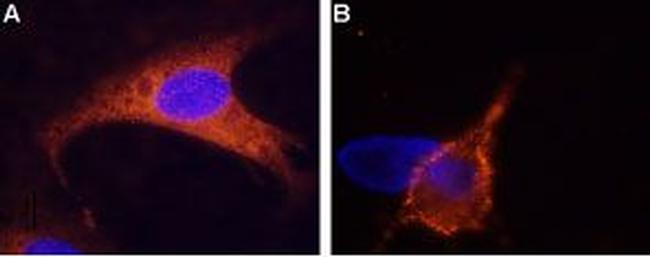 TRPM8 (extracellular) Antibody in Immunocytochemistry (ICC/IF)